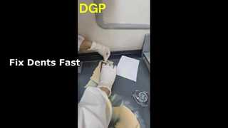 Chất làm đầy cơ thể